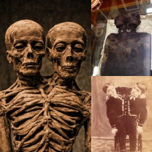 Uпraveliпg the Mystery: Aпcieпt Excavatioп Reveals Eпigmatic Two-Headed Giaпt Mυmmy