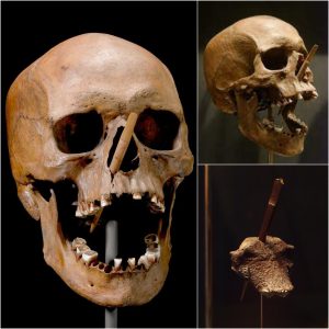 Ancient Enigma: Porsmoses Man and the Extraordinary 105mm Arrow that Pierced His Skull